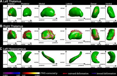 Frontiers Brain Cortical Complexity and Subcortical